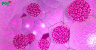 Bệnh viêm cổ tử cung mãn tính: Tìm hiểu nguyên nhân và cách chữa